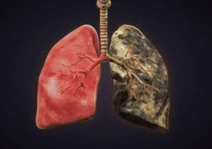 肺癌中晚期的症状较为明显，发现需紧急治疗