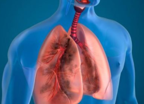 肺癌的治疗方法有哪些传染吗