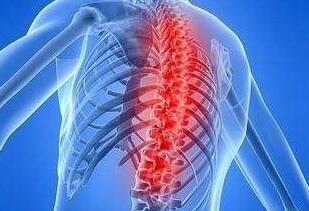 这些方法是治疗强直性脊柱炎的，你了解吗?