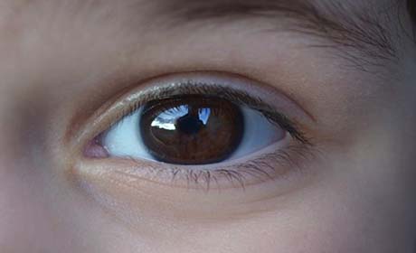 眼部皱纹影响美观，如何去除效果好呢？