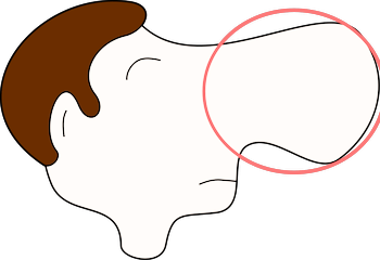 耳鼻喉专科医院-预防鼻息肉的方法有哪些