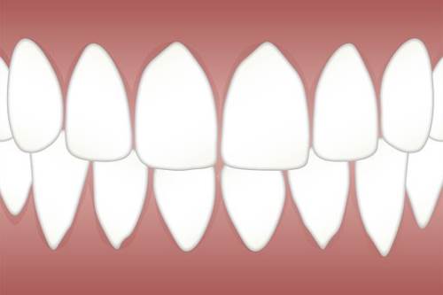 正确的认识牙齿矫正，不要盲目矫正牙齿