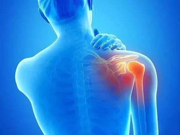 肩部疼痛警惕肩周炎，6个方法来预防！