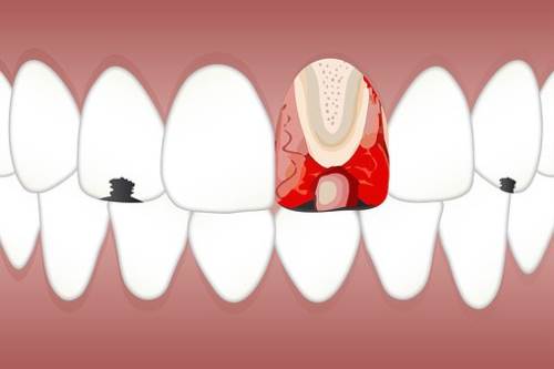 牙齿松动该怎么办呢?如何治疗呢?