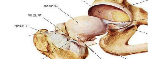 北京治疗股骨头坏死的医院？