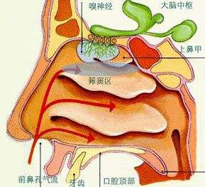 鼻窦炎难以医治吗？什么原因造成的？