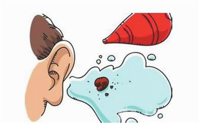 外耳道炎会引起耳鸣吗？该如何预防？