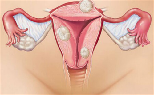  什么是卵巢位置异常？患上之后应该怎么办？早看早知道
