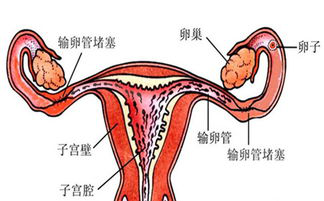 卵巢炎是怎么引起的？对女性有什么危害？千万不能忽视