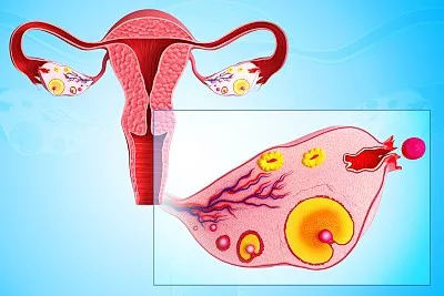 输卵管堵塞了！应该怎样治疗输卵管堵塞呢？