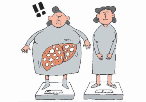 脂肪肝的病因是什么？快看下你中招了吗？