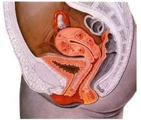子宫腺肌症对身体有哪些危害?怎样预防子宫腺肌症的出现?