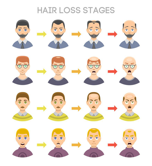 秃顶植发手术原理是什么？需要多少钱？听听专家怎么说？