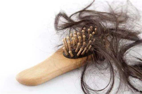 脱发是什么原因造成的，秃发面积太大可以去做植发吗？了解清楚才放心
