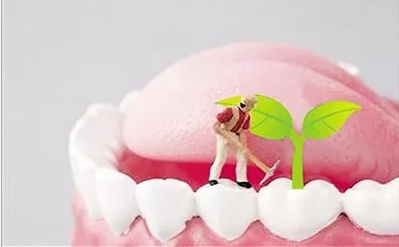 牙齿缺失的危害有哪些？种植牙的优势有哪些？你想知道的全在这里