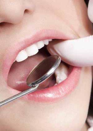 为什么要定期洗牙？定期洗牙对牙齿有什么益处？