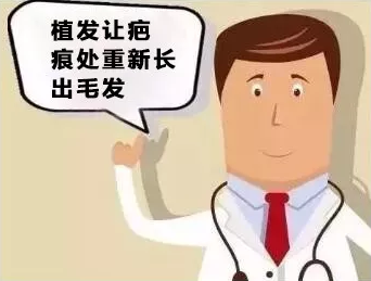 疤痕植发该如何治愈呢？前后应该注意哪些，进来告诉你！