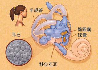 北京看耳鼻喉哪个医院好-耳石症有什么常见的症状