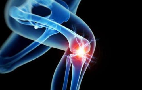 膝关节滑膜炎可以预防吗？这些方法分享给大家！