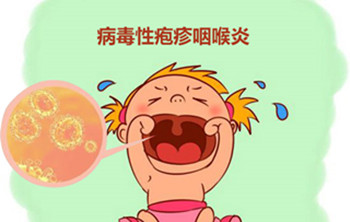 北京看耳鼻喉好的医院排名-咽喉炎所引发的危害
