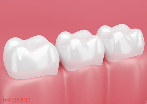 牙齿界最简单的美白修复项目——牙齿贴面