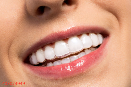牙齿美白界的黑科技，你知道多少？