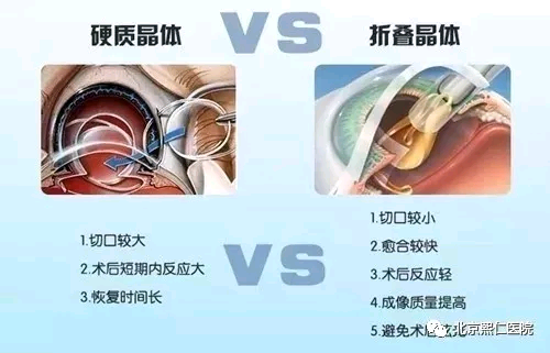北京熙仁眼科医院：教您如何选择人工晶体!