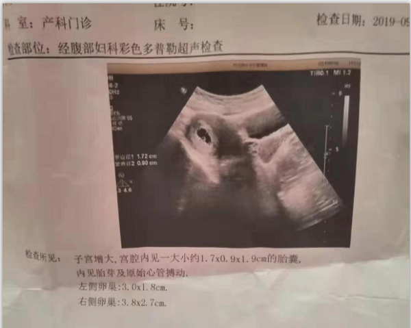 黑龙江虹桥不孕不育医院 | 求子多年，她终于怀孕了......
