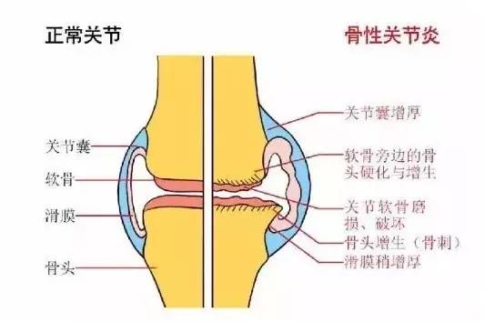 膝盖越动越疼，为什么受伤的总是你？