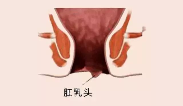 北京丰益肛肠医院：“医生，我肛部里长出了小尾巴，是啥东西？”