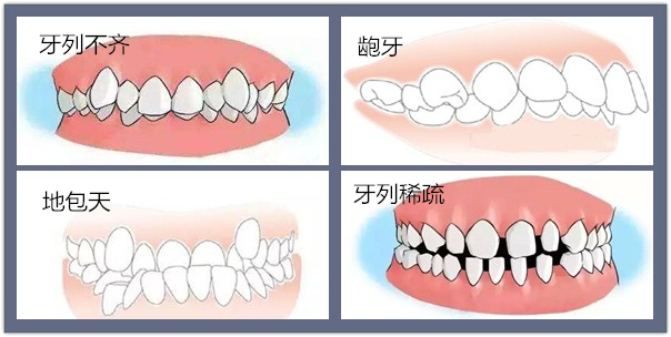 麦芽“拯救歪牙”夏令营开营！考分当钱花！