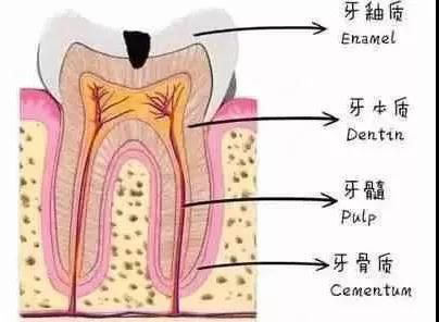 医生介绍：龋齿的治疗方法有哪些？了解清楚才放心