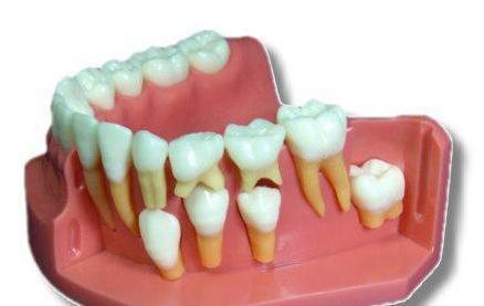 医生温馨提示：别错过牙齿矫正的较佳时机