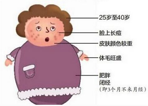 多囊卵巢患者应该如何自然受孕？自然受孕的几率高吗？