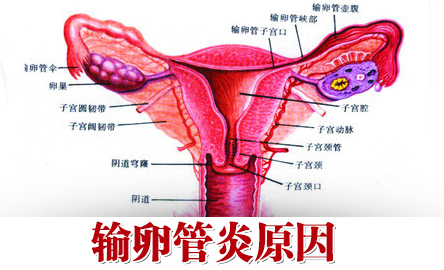 哪些因素会导致输卵管阻塞？生活当中一定要注意这几个原因