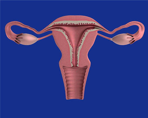 子宫肌腺症是什么？你知道吗