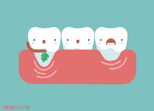 洗牙的十大真相，你知道几个呢？