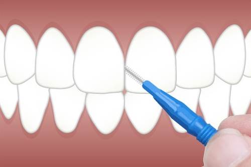 美白牙齿需要注意些什么?牙齿清洁有哪些方法?