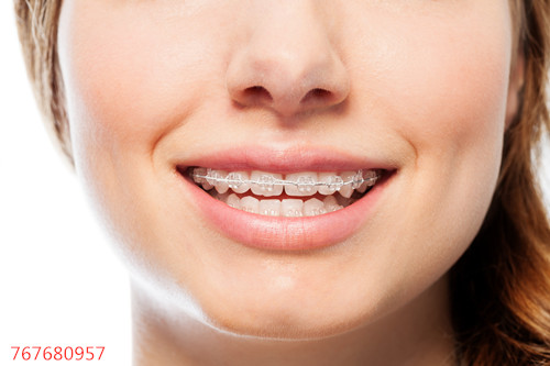 正畸过程中牙齿移动是什么原理呢？