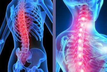 强直性脊柱炎的症状有哪些?医生给患者的忠告有哪些? 　　