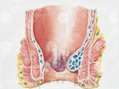 肛门处有异物感是什么疾病引起的?应该如何检查？