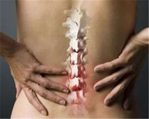 强直性脊柱炎能治愈吗？日常生活中有哪些护理方法呢？