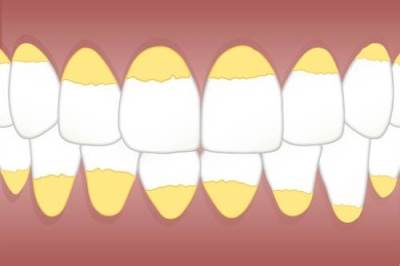 怎么用日常的办法改善牙齿黄，快把小妙招学起来