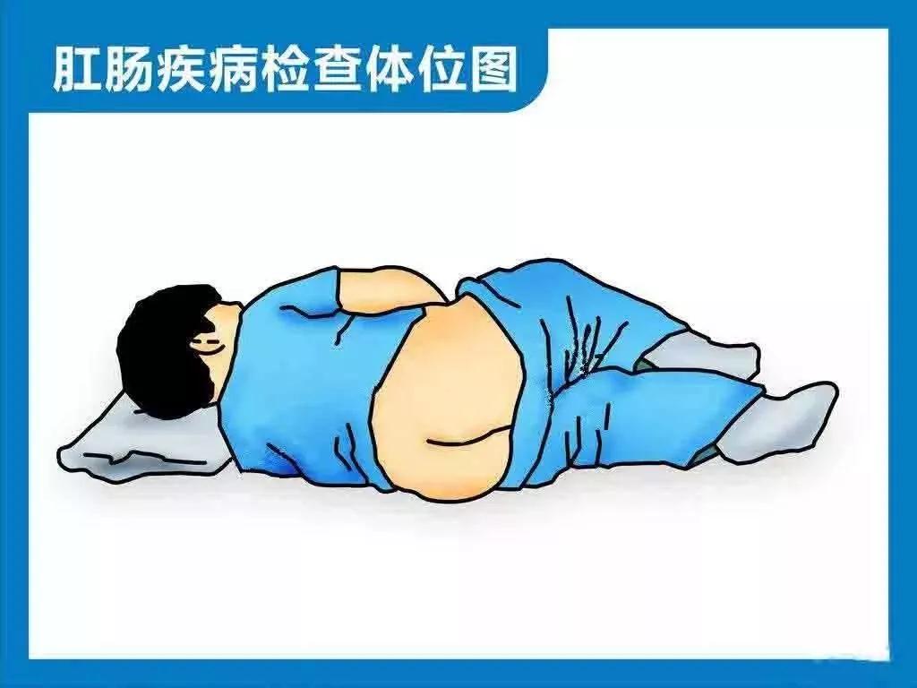 北京丰益肛肠医院：医生是如何诊断痔疮的？