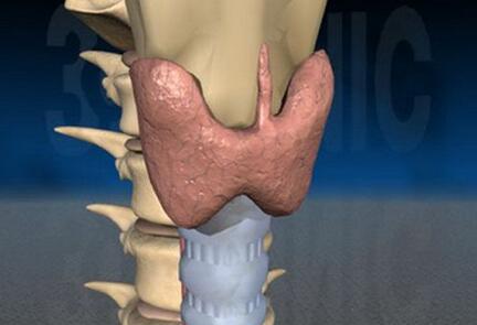 甲状腺结节是什么原因引起的?