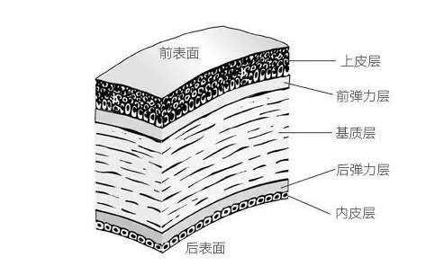 自己需要做近视手术，如何选择一种的手术方式