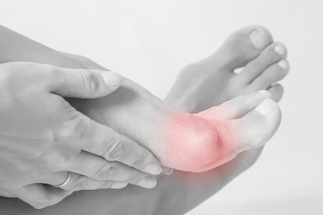 【大脚骨】拇外翻怎么治疗？目前的治疗方法能够有效治好拇指外翻吗？