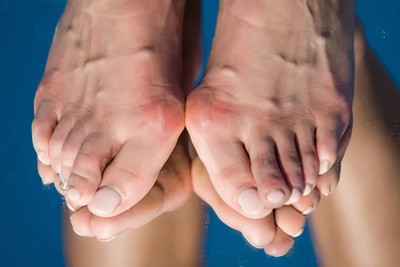 脚拇指外翻的症状有哪些呢?这些症状你知道多少?