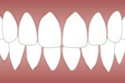 治疗牙齿变黄的办法是什么，看完这篇改善你的牙黄