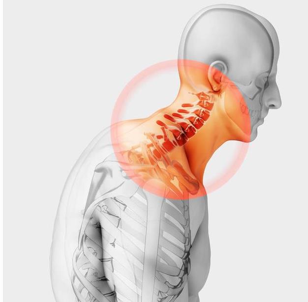 康复大夫揭秘：约1.5亿人患颈椎病 如何对颈椎病说不 